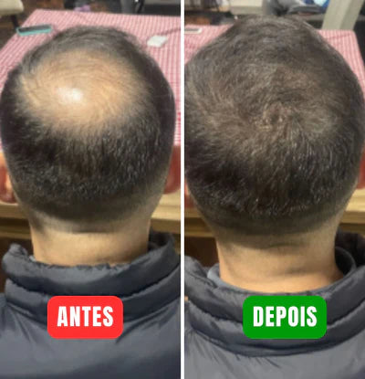 Magic Colour - Elimine a calvície em minutos!