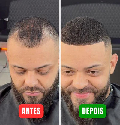 Magic Colour - Elimine a calvície em minutos!