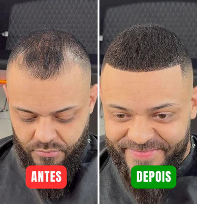Real Hair Fibers - Transforme seu visual em minutos! (1 Spray Fixador + Aplicador Grátis)