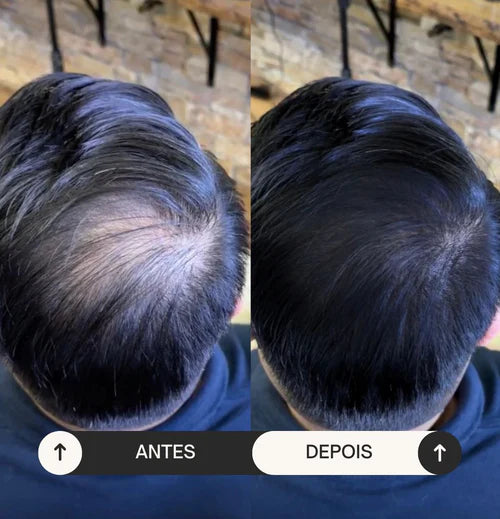 Batci Hair - Recupere o seu cabelo em minutos! (Compre 1 Ganhe 2)