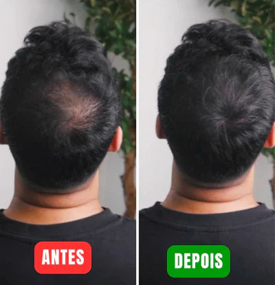 Real Hair Fibers - Transforme seu visual em minutos! (1 Spray Fixador + Aplicador Grátis)