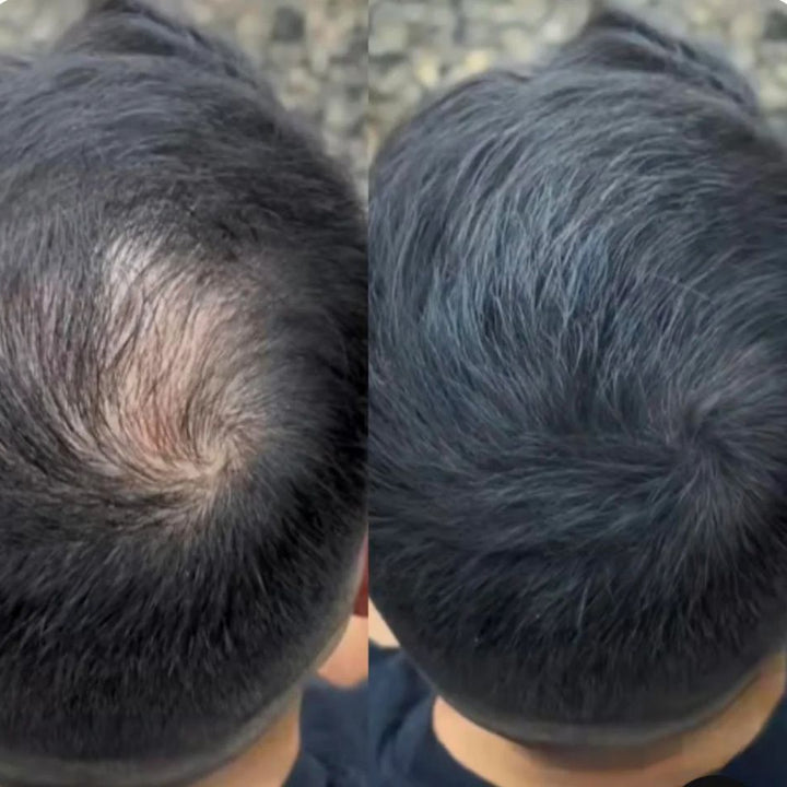 Hair Cover - Preenchimento Capilar em 1 Minuto!