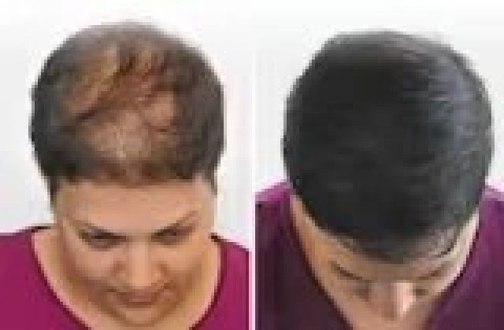 Hair Cover - Preenchimento Capilar em 1 Minuto!