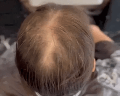 Magic Colour - Elimine a calvície em minutos!